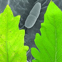 A tomato plant leaf infected by Xanthomonas showing symptoms of the disease (left) compared to a healthy tomato plant leaf (right). Behind this is a scanning electron micrograph of Xanthomonas bacteria inside the leaf of a plant. (Image: Sebastian Schornack, Gerd Hause, Jens Boch)